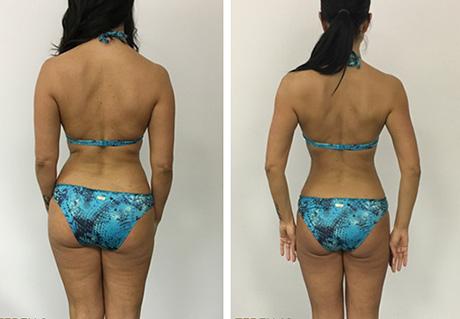 Sibila 
je izgubila
11 kg